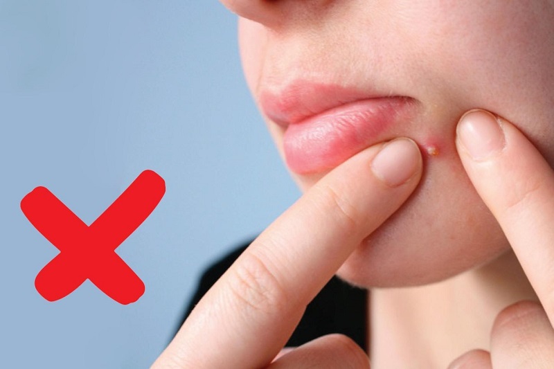Sai lầm khi tự nặn mụn tại nhà – Tưởng tốt nhưng hại da trầm trọng