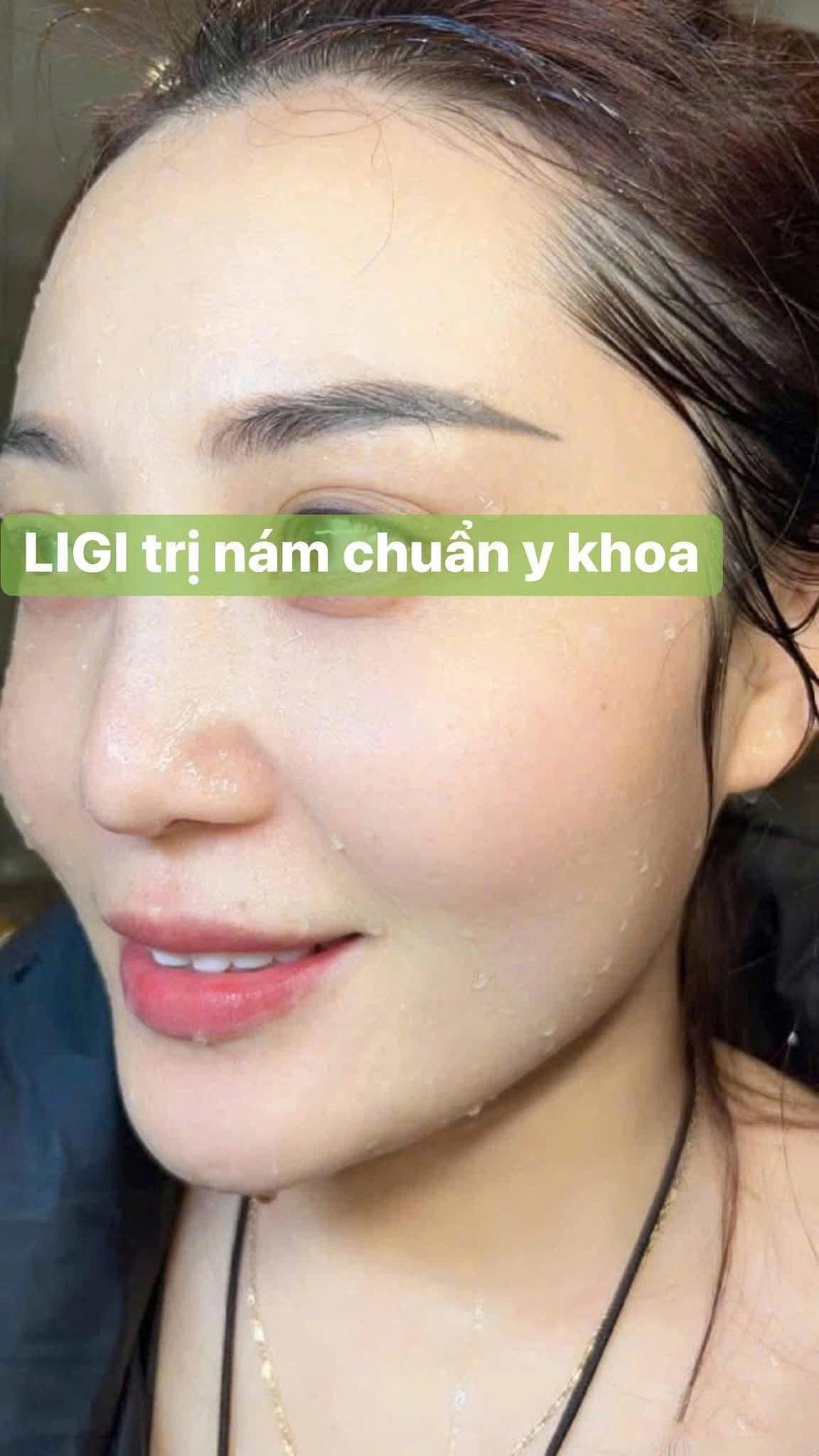 HÀNH TRÌNH TRỊ NÁM CÙNG C KHÁCH THÁI BÌNH